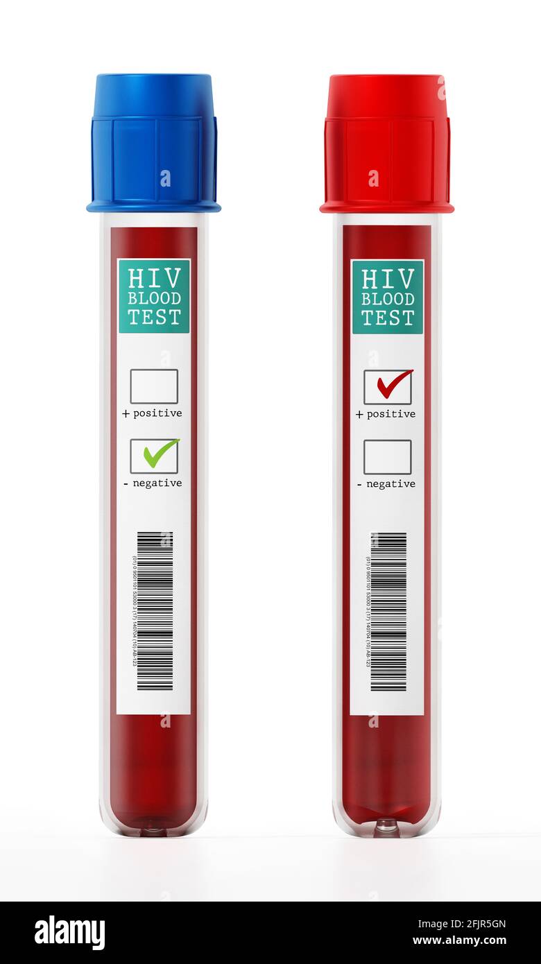Campioni di sangue positivi e negativi in fiale con etichette per test HIV. Illustrazione 3D. Foto Stock