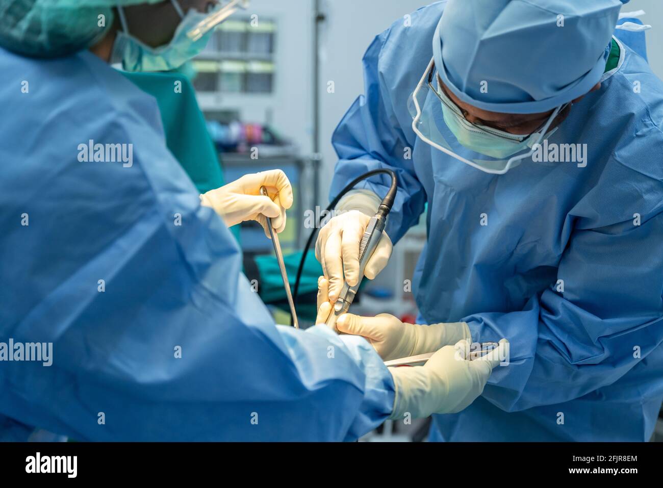 Team medico di chirurghi e assistente in ospedale che fa chirurgia ortopedica. Sala operatoria chirurgica con apparecchiature di elettrocauterizzazione per e cardiovascolare Foto Stock