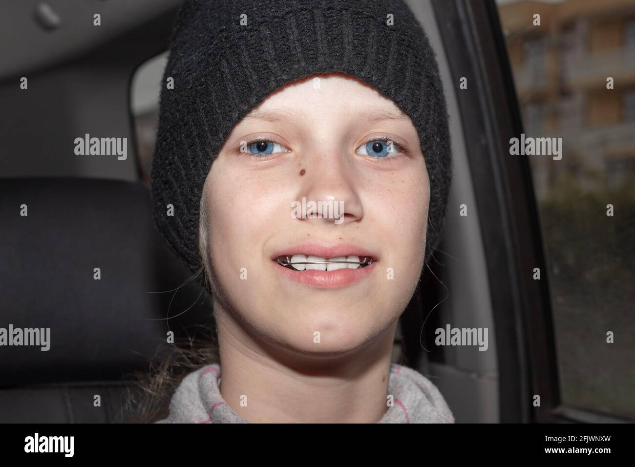 Una ragazza adolescente in un cappello nero con bretelle di ferro sui denti sorride mentre si siede in un salone di auto. Raddrizzare il morso e la bellezza dei denti. Foto Stock