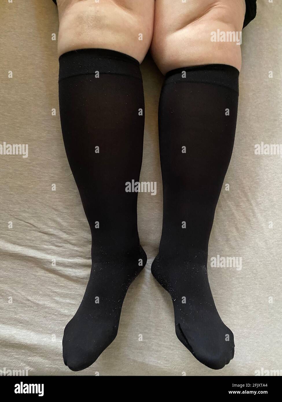Donna indossa calze a compressione. Soffre di insufficienza venosa cronica con cellulite lieve alle gambe. Poggiare con la gamba rialzata Foto Stock