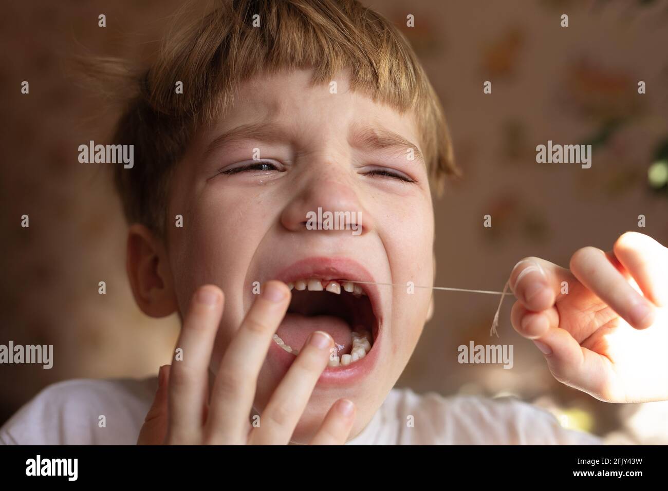Ritratto di ragazzo sconvolto piangendo. Primo piano di capretto frustrato è triste e doloroso rimuovere i denti del bambino, gridando nel dolore. Foto Stock