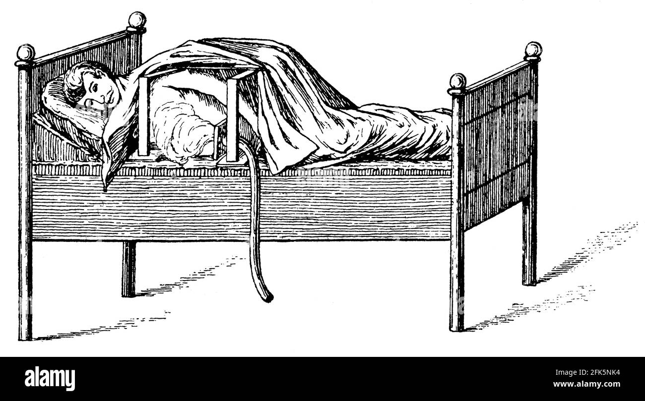 Letto bagno di vapore (corpo). Illustrazione del 19 ° secolo. Germania. Sfondo bianco. Foto Stock