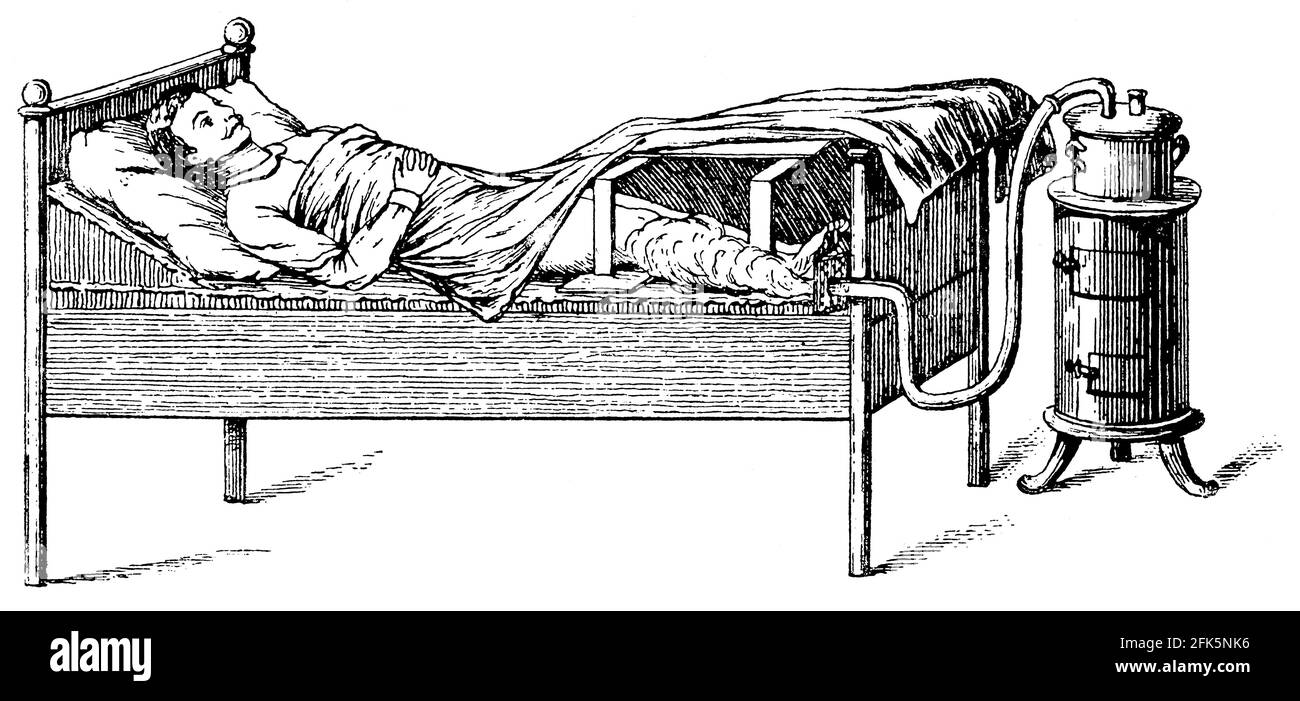 Bagno di vapore a letto (gamba). Illustrazione del 19 ° secolo. Germania. Sfondo bianco. Foto Stock