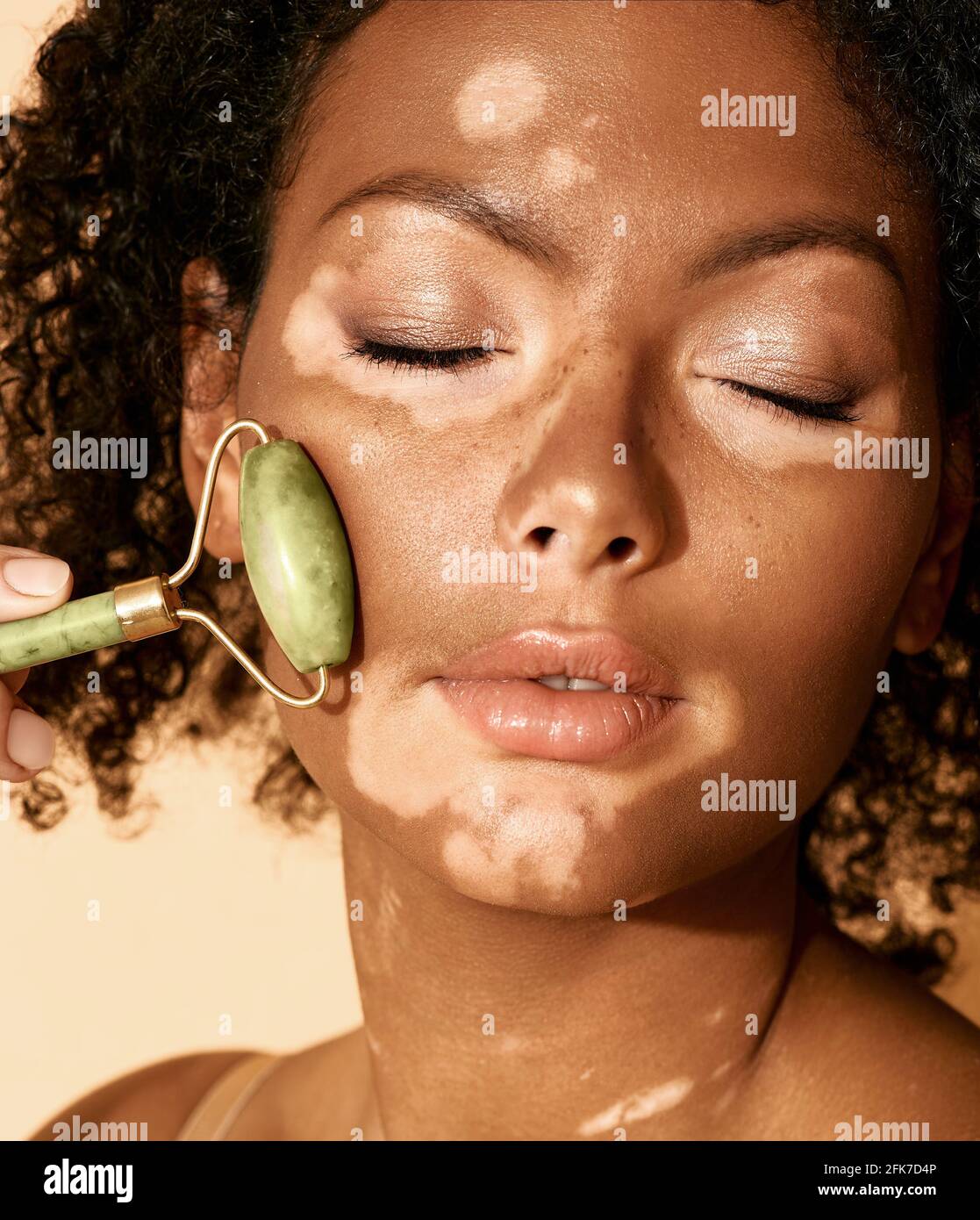 Donna con vitiligine usa un rullo di giada verde, primo piano. trattamento viso con caratteristiche della pelle Foto Stock