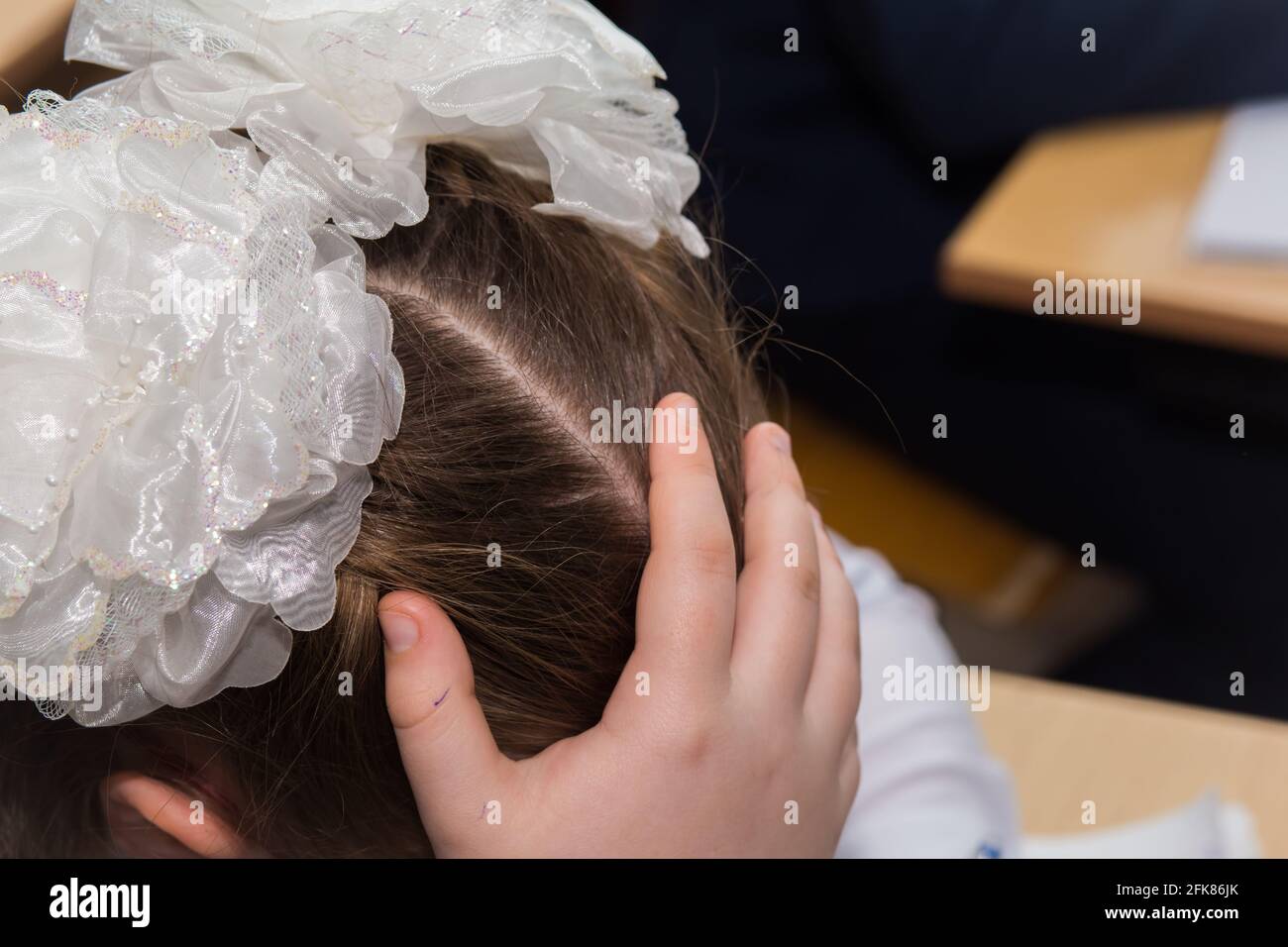 La mano della ragazza che sostiene la testa e fiocchi bianchi sulla testa. La ragazza si siede alla sua scrivania a scuola e pensa. Lo styling dei capelli è fatto con i archi. Solo una testa con un taglio. Foto Stock