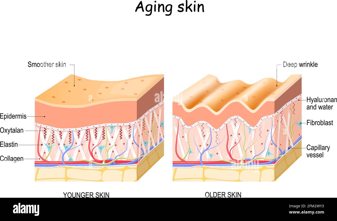 Confronto e differenza tra pelle più vecchia e più giovane. Primo piano di  fibroblasti, collagene, elastina e fibre di Oxytalan, acido ialuronico  Immagine e Vettoriale - Alamy