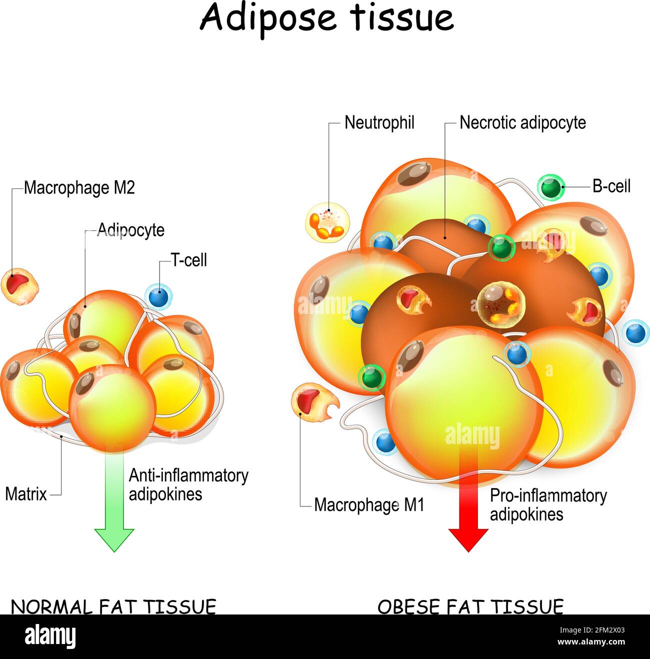 Adipociti, obesità e infiammazione. Tessuto adiposo normale, metabolismo e tessuto adiposo obeso. Patologia dell'obesità. Antinfiammatori e pro-infiammatori Illustrazione Vettoriale
