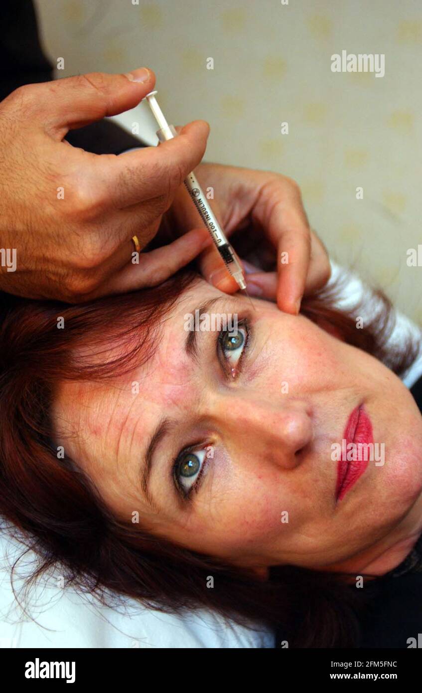 ALEX KARIDAS CHE AMMINISTRA BOTOX A JOAN CORMACK.8/2/02 PILSTON Foto Stock