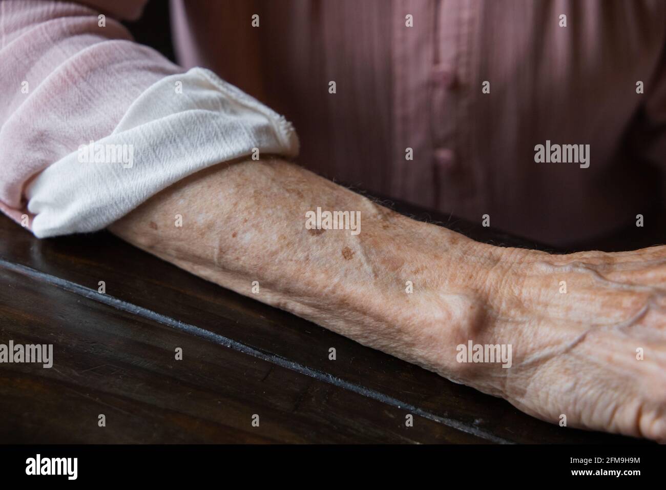 Anf braccio di nonna anziana con rughe e macchie di età. Foto Stock