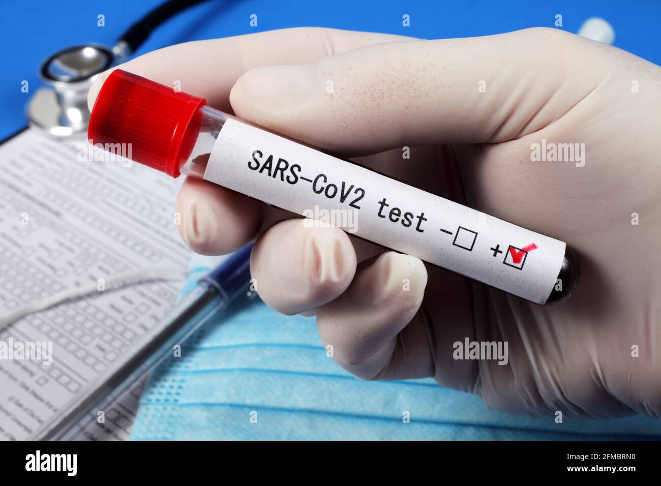 SARS - Test CoV2, provetta a vuoto con sangue nella mano del medico, messa a fuoco selettiva, primo piano. Foto Stock