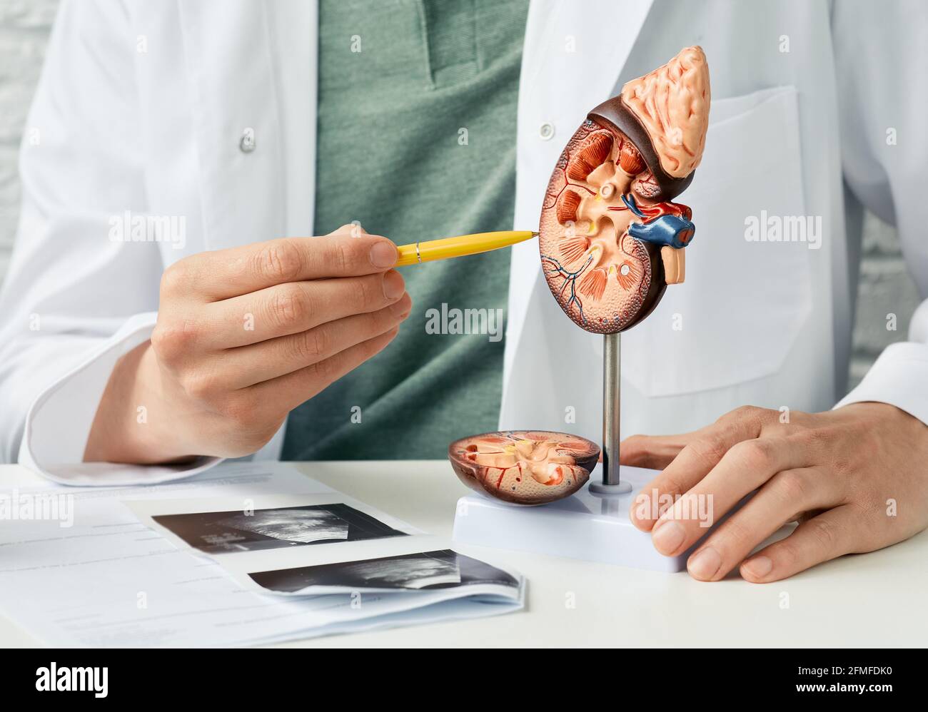 Urologia e trattamento della malattia renale. medico analisi della salute renale del paziente utilizzando ecografia renale e modello anatomico Foto Stock