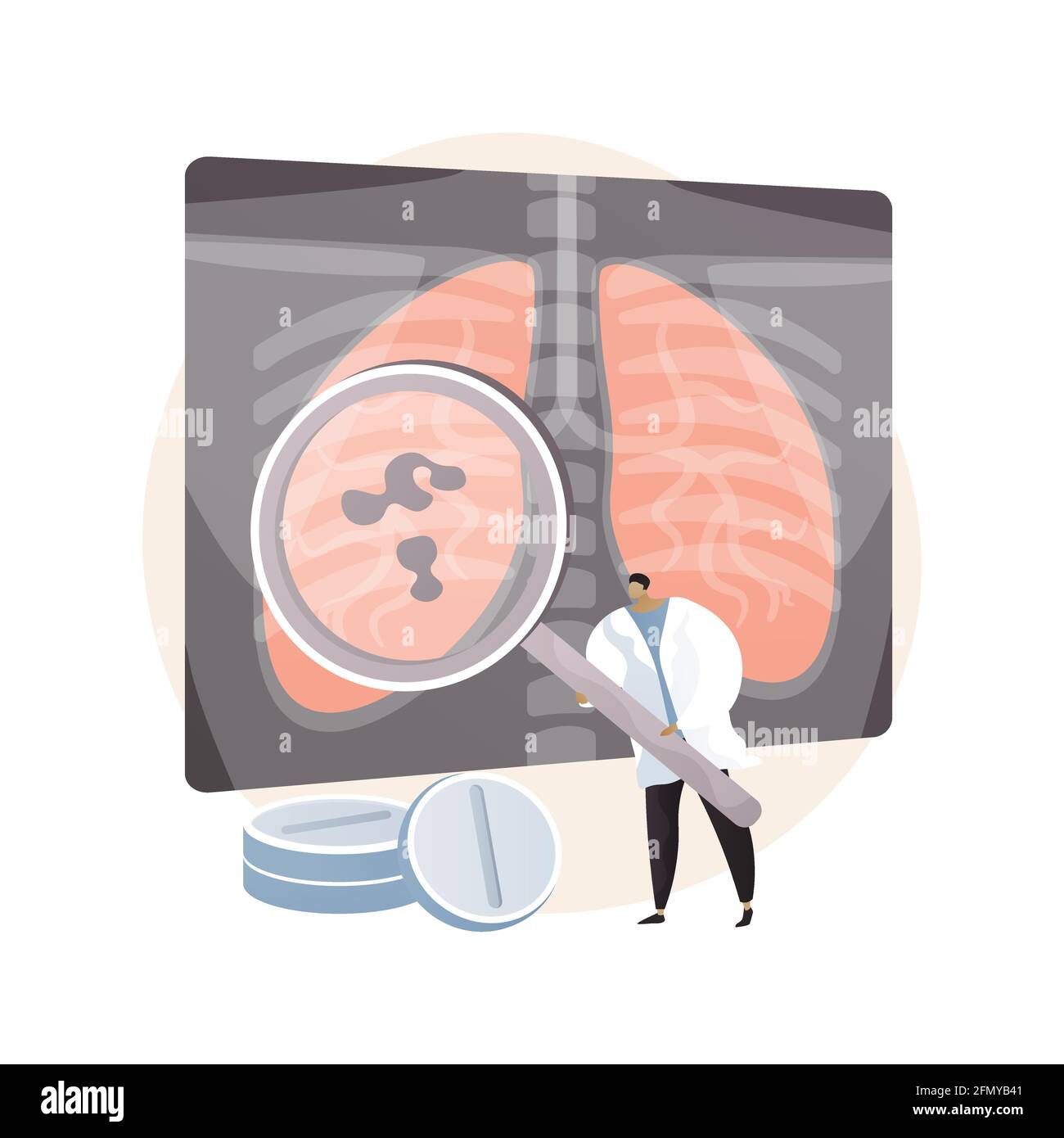 Illustrazione vettoriale astratta delle infezioni respiratorie inferiori. Illustrazione Vettoriale