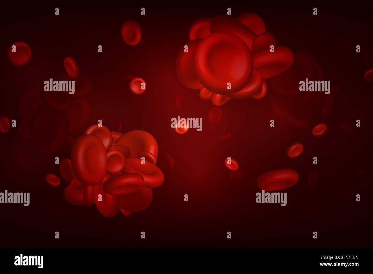 Coaguli di sangue, trombo o embolo con eritrociti coagulati. Illustrazione Vettoriale