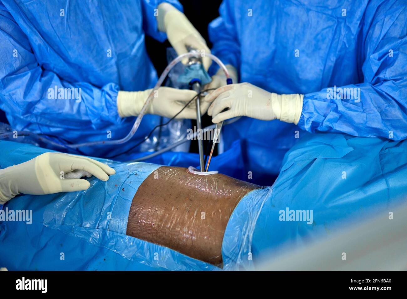 I chirurghi multietnica in maschere mediche operando il paziente in sala operatoria Foto Stock