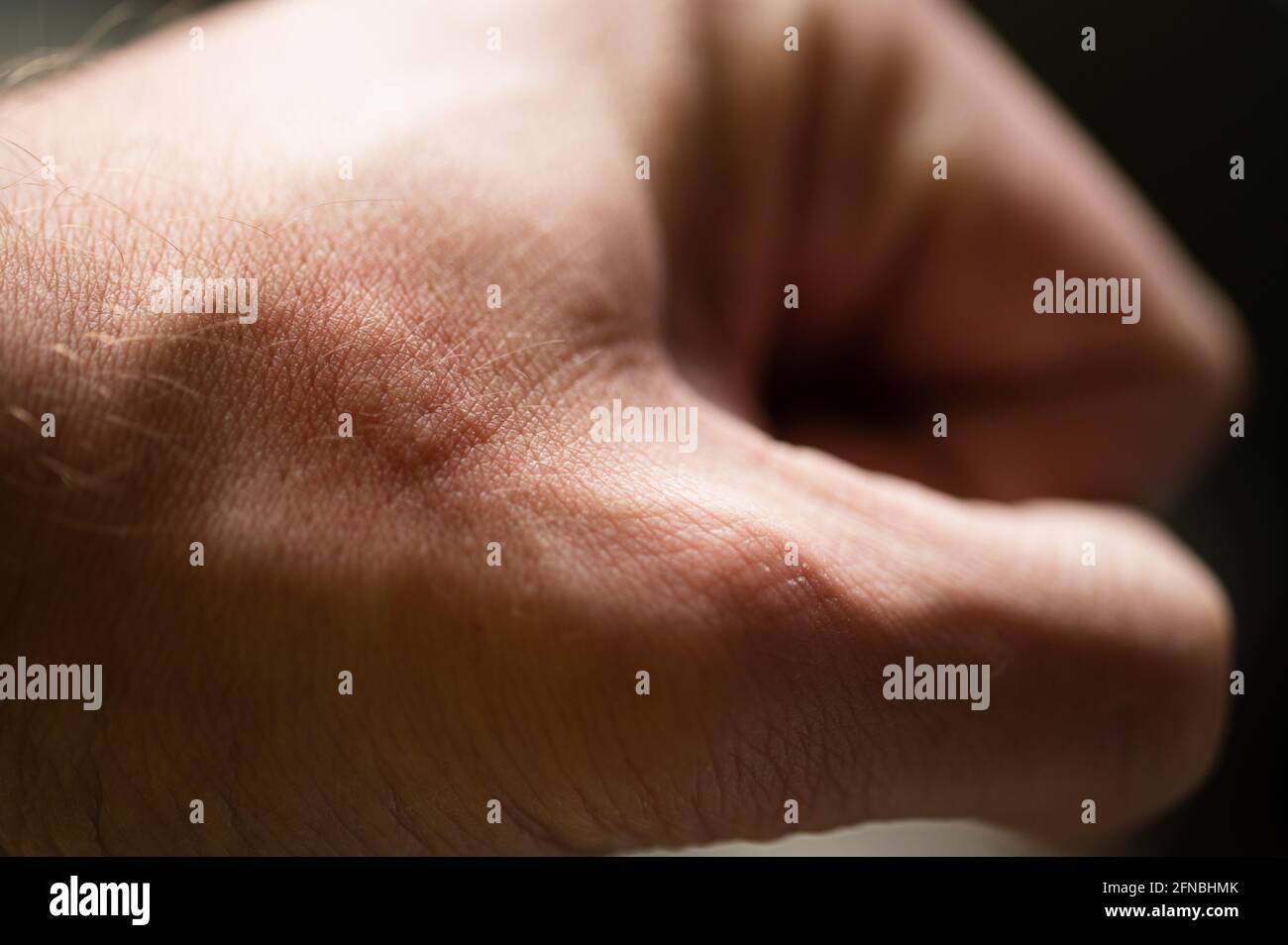 Reazione allergica a immagini e fotografie