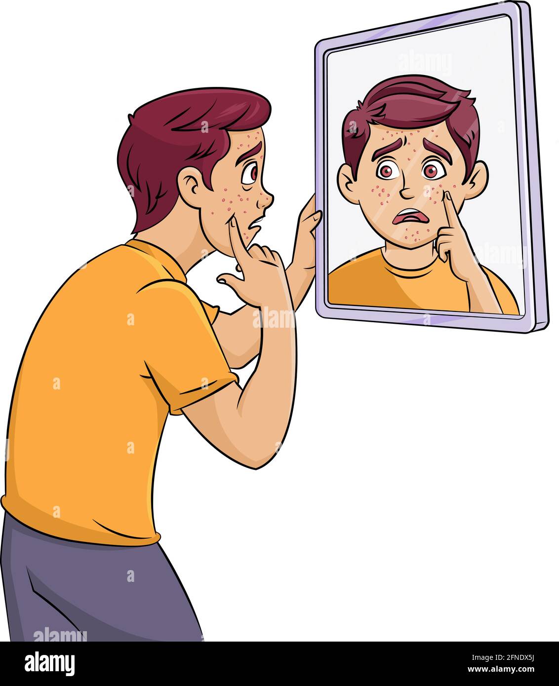 Cartoon vettore illustrazione di un ragazzo adolescente con pimples Illustrazione Vettoriale