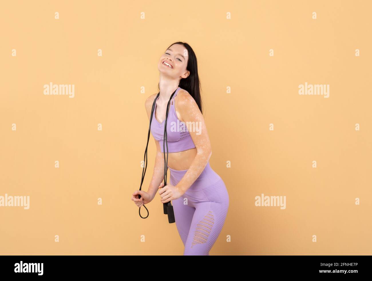 Giovane donna sportiva con disturbo della pelle di Vitiligo che tiene la corda saltante Foto Stock