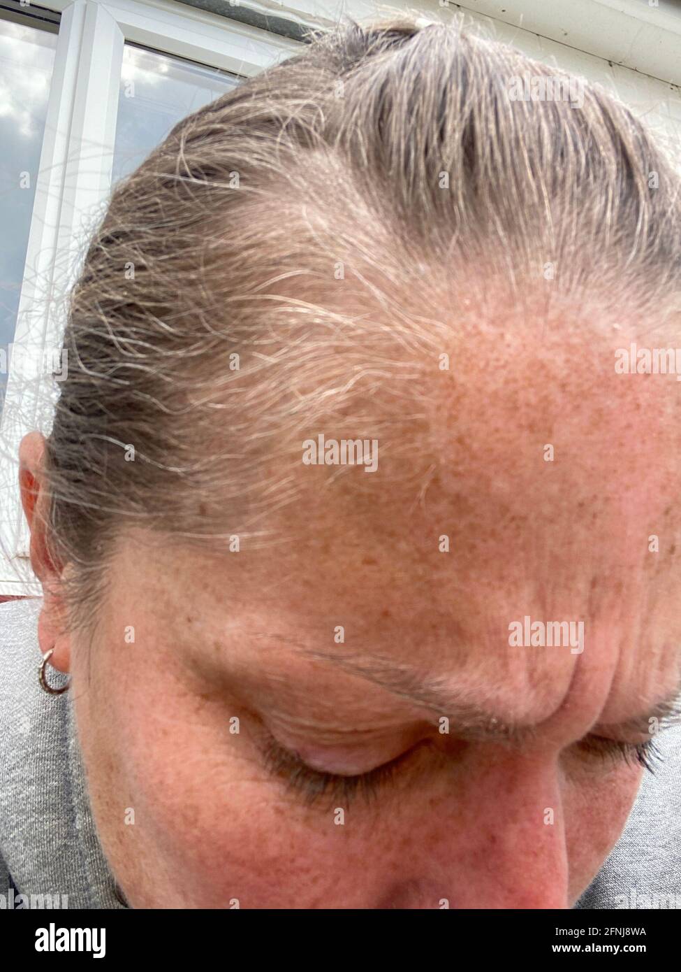 melasma lentigo sulla pelle di una macro foto uomo. Pigmentazione cutanea melasma iperpigmentazione con età, macchie di pigmento, invecchiamento della pelle Foto Stock