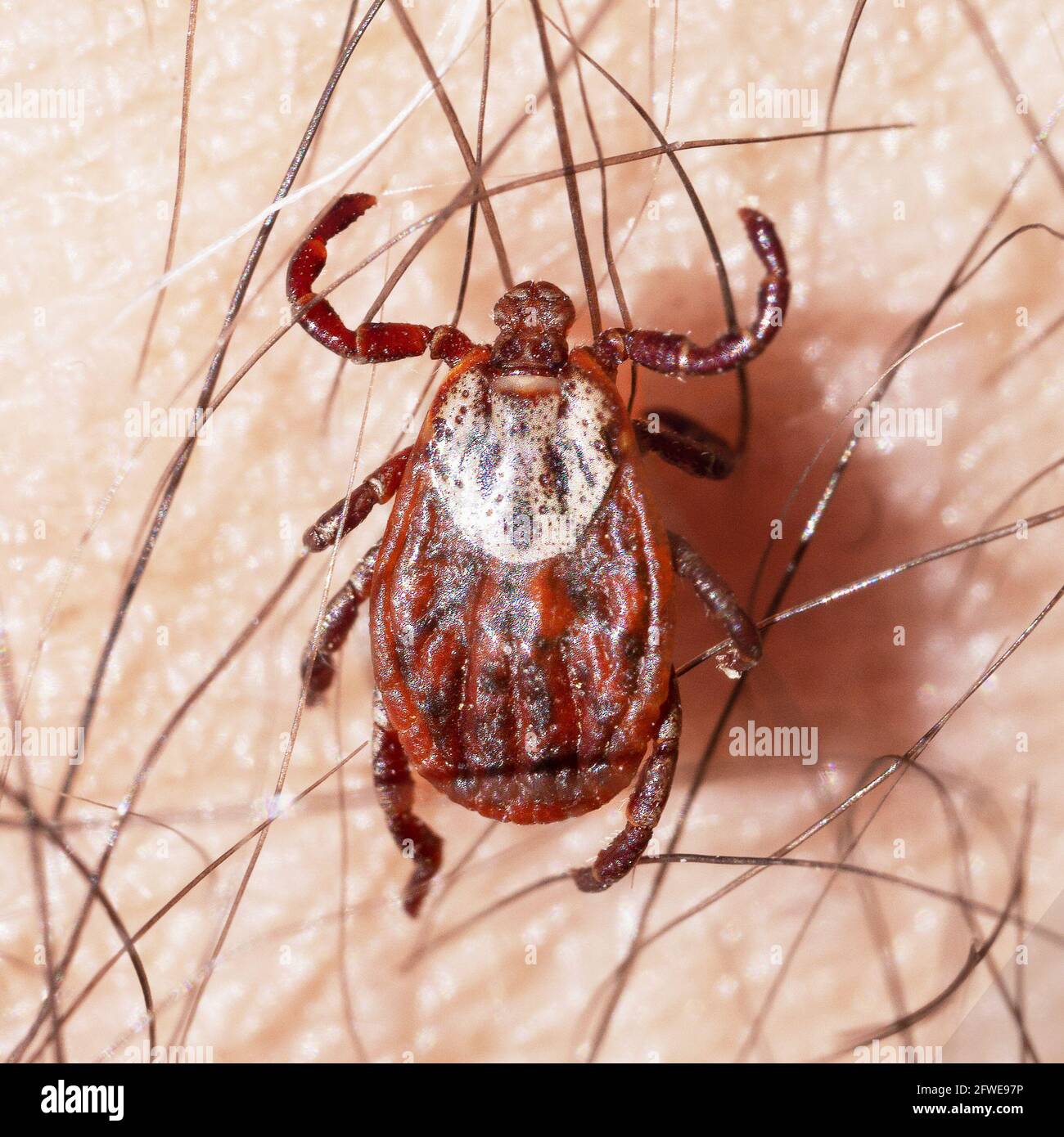 Acaro che succhia sangue su un macro della pelle umana Foto Stock