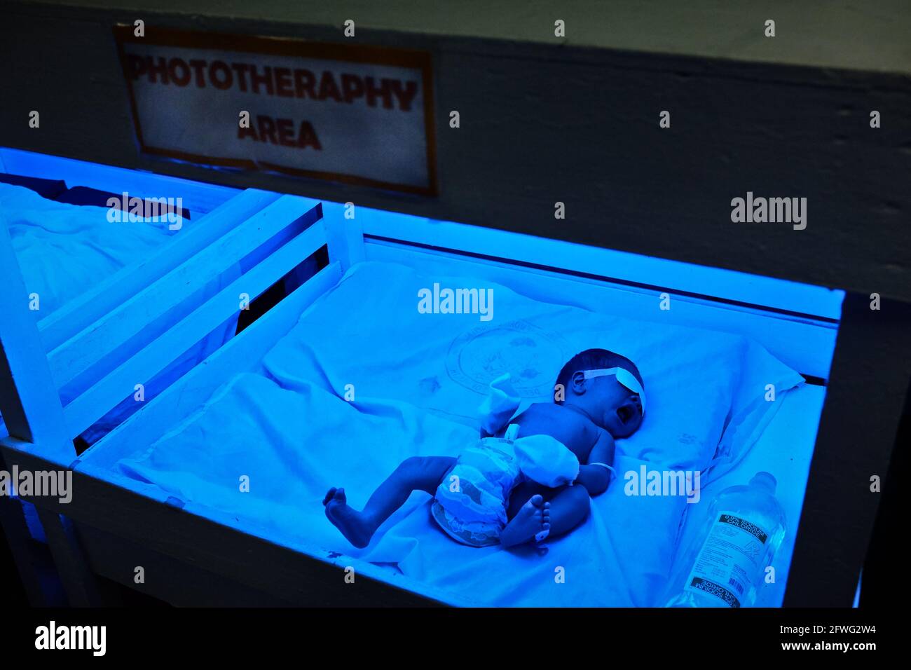 Un nuovo nato durante una fototerapia al reparto di maternità dell'ospedale Jose Fabella a Manila, Filippine. È il più trafficato del mondo. Foto Stock