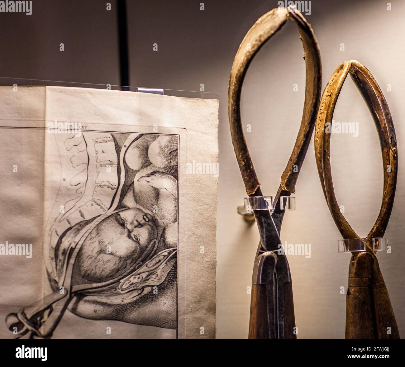Primi strumenti medici obstetici (pinze in legno) per distocia. Mostra al Rijksmuseum Boerhaave a Leiden, Paesi Bassi Foto Stock