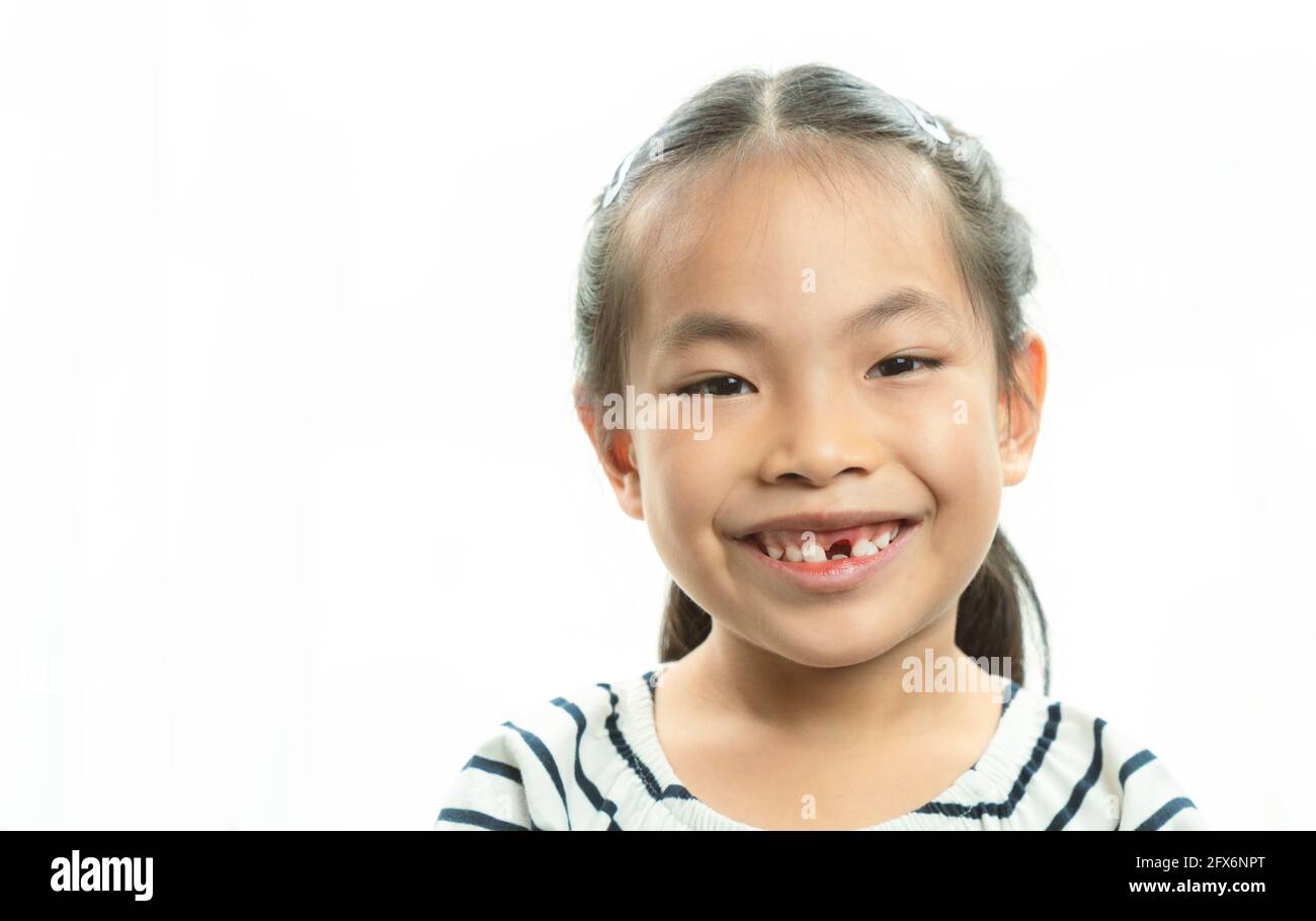 Adorabile bambina asiatica sorridente e mostrando il suo primo dente di latte perso. Carino ritratto Asian bambina dopo aver fatto cadere il suo dente di latte anteriore, fre Foto Stock