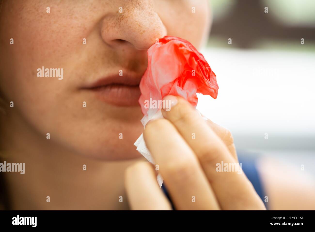 Donna cerca di fermare il sangue che fuoriesce dal naso Foto Stock