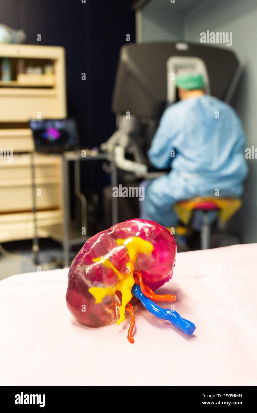stampa 3d di un rene. Chirurgia renale conservativa robotica guidata da immagini assistita da modellazione 3D, questa modellazione 3D del rene con le sue guide tumorali th Foto Stock