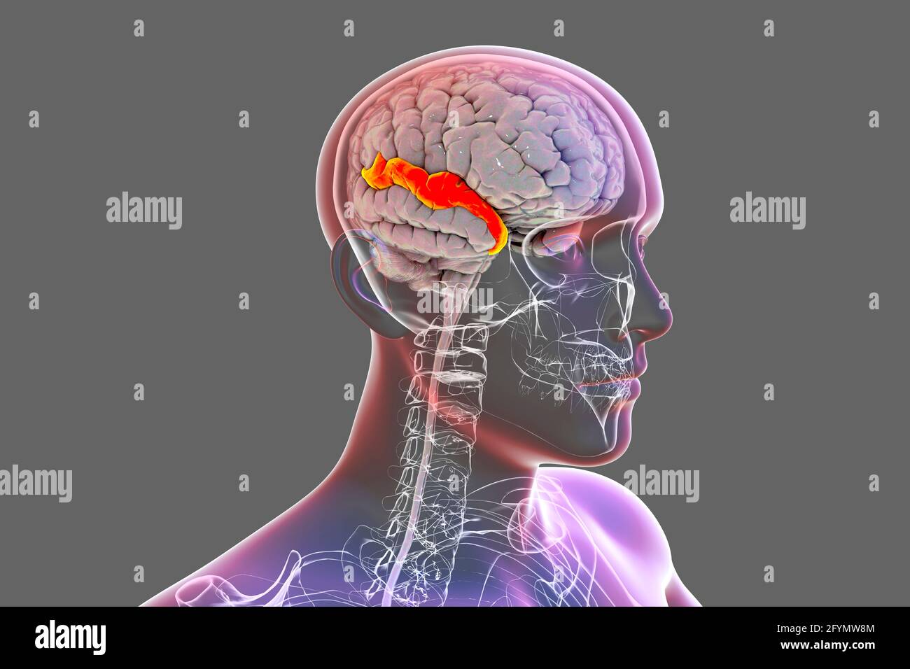 Cervello con girus temporale superiore evidenziato, illustrazione Foto Stock