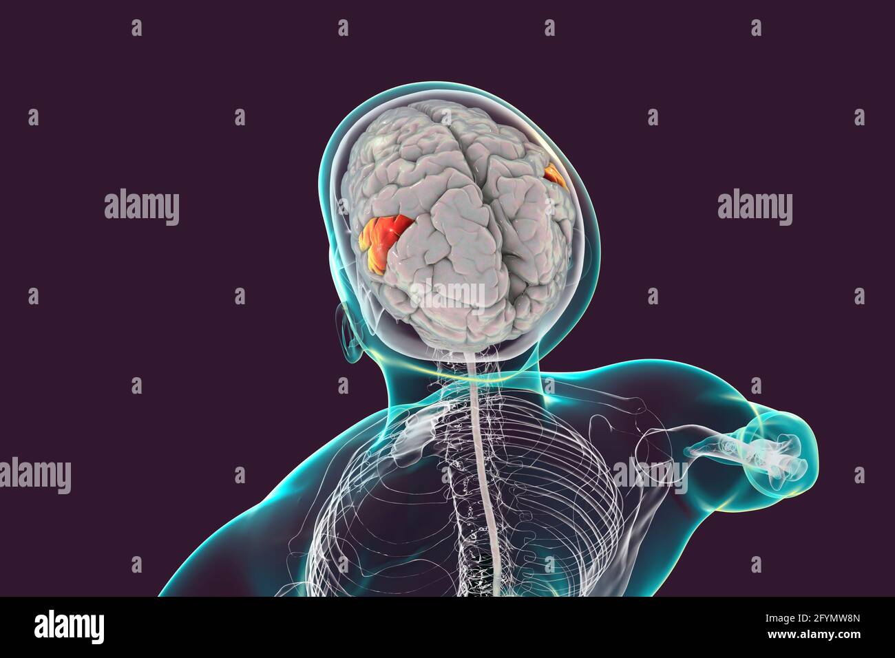 Cervello con gyrus sopramarginale evidenziato, illustrazione Foto Stock