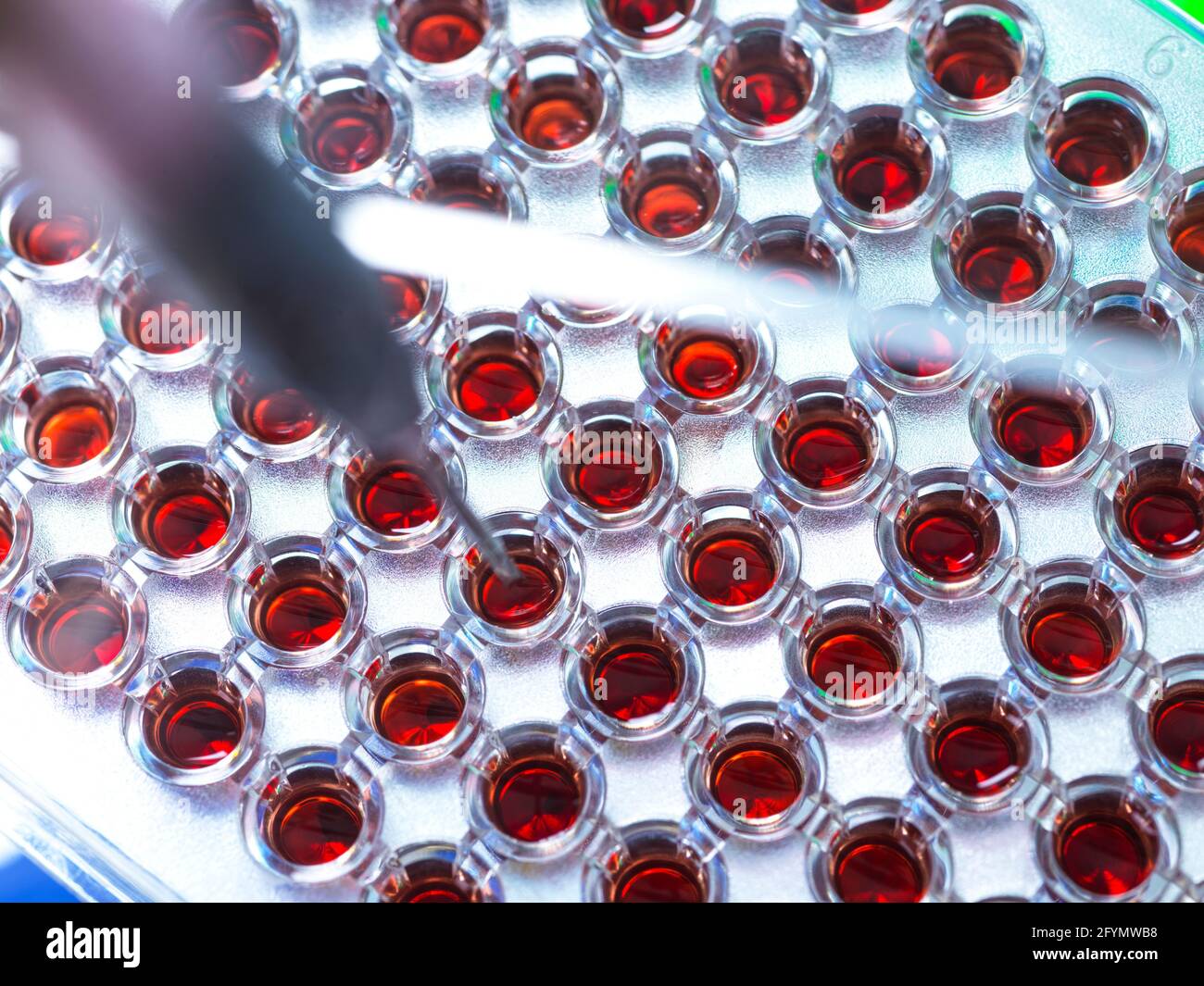 Analisi del sangue Foto Stock