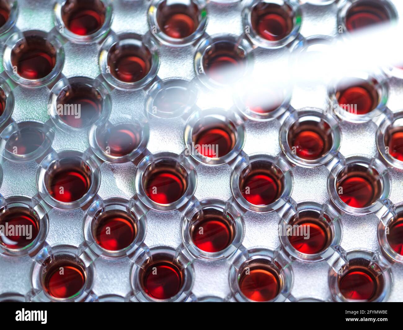 Analisi del sangue Foto Stock