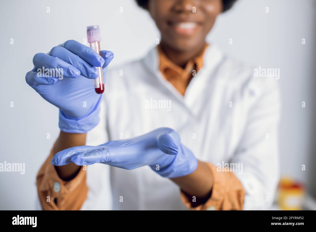 Provetta per analisi del sangue nelle mani di una donna. Primo piano visione offuscata di una simpatica assistente di laboratorio o scienziata afro-americana in guanti blu, contenente una provetta con il campione di sangue. Covid-19 pandemia Foto Stock