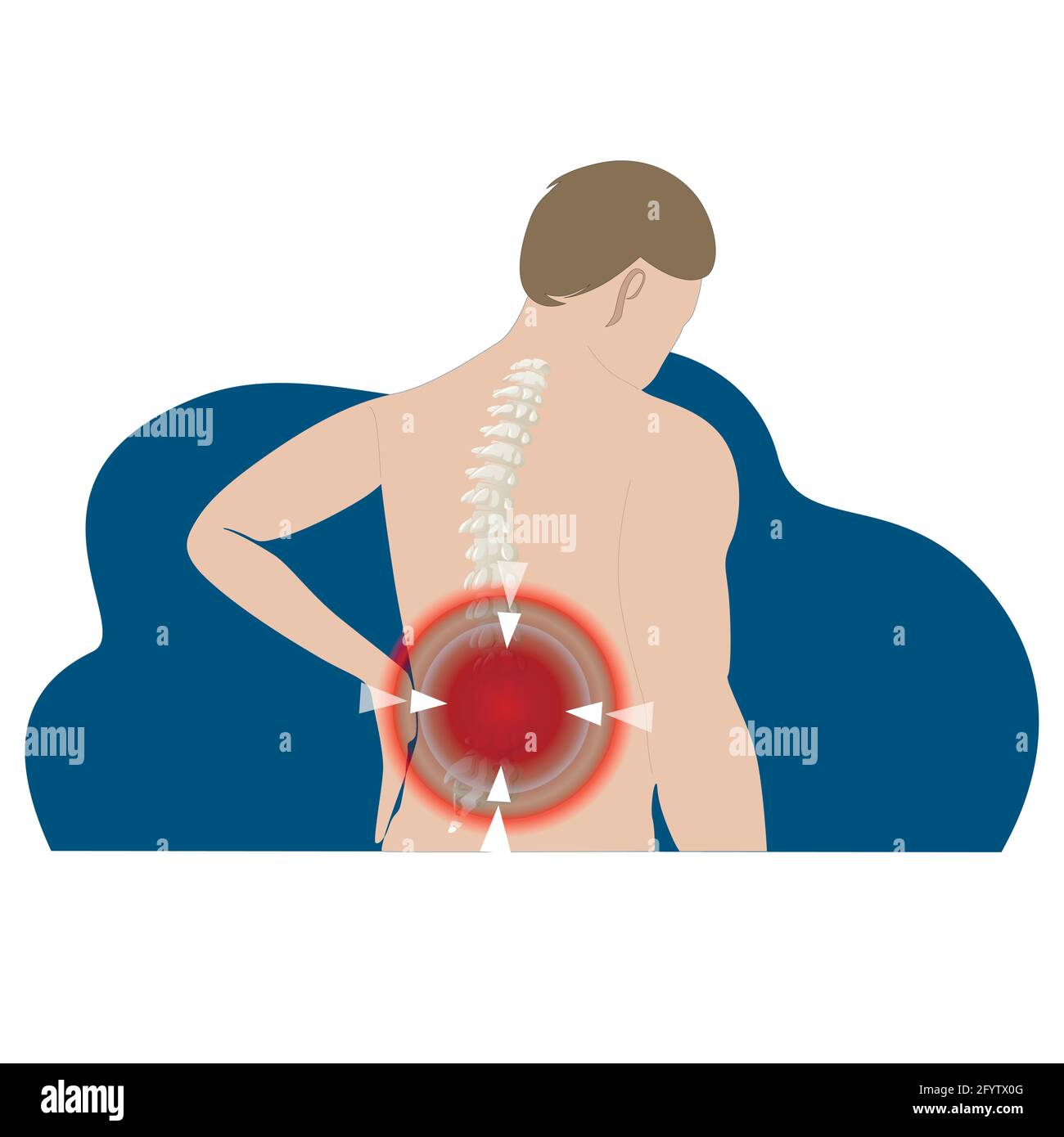 Dolore alla schiena, tensione di allungamento o sporgenza, disco erniato. Punto di dolore vettoriale nello scheletro, mal di corpo, lesione vettoriale della colonna vertebrale, mal di schiena vertebre, hur Illustrazione Vettoriale