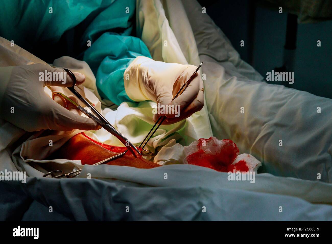 Chirurgo medico chirurgia gamba del paziente con sala operatoria ospedale in ospedale Foto Stock