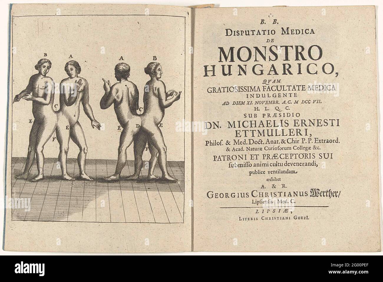 Title page for: M.E. Ettmüller, disputatio Medica de Monstro HungariCo, 1707. Pagina del titolo per: M.E. Ettmüller, disputatio Medica de Monstro Hungario, Lipsia 1707. Frontespizio con il titolo stampato, d'altra parte, il frontespizio con due performances dei gemelli ungheresi Siamesi. Foto Stock