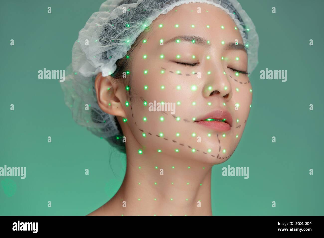 Giovane donna fa laser cosmetic Foto Stock