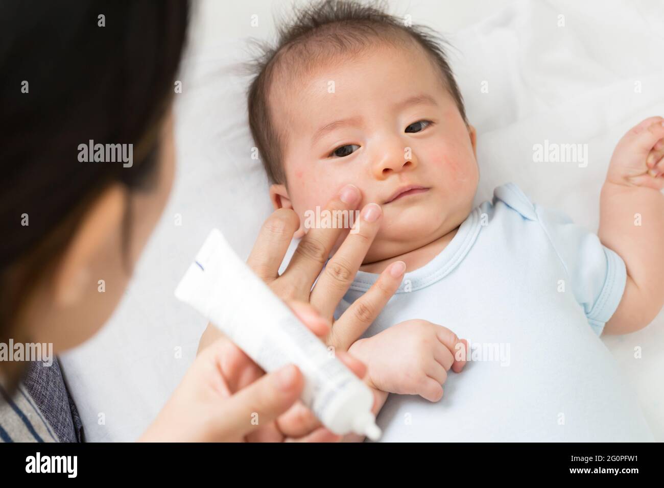 La madre sta applicando la crema al bambino che aiuta a mantenere l'idratazione della pelle del viso, Skincare e crema idratante concetto Foto Stock