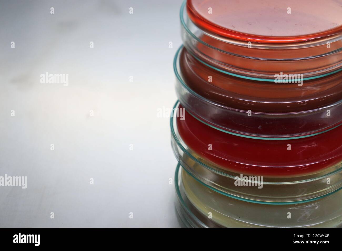 Un mezzo di crescita o terreno di coltura è un solido, liquido o semisolido progettato per supportare la crescita di una popolazione di microrganismi Foto Stock