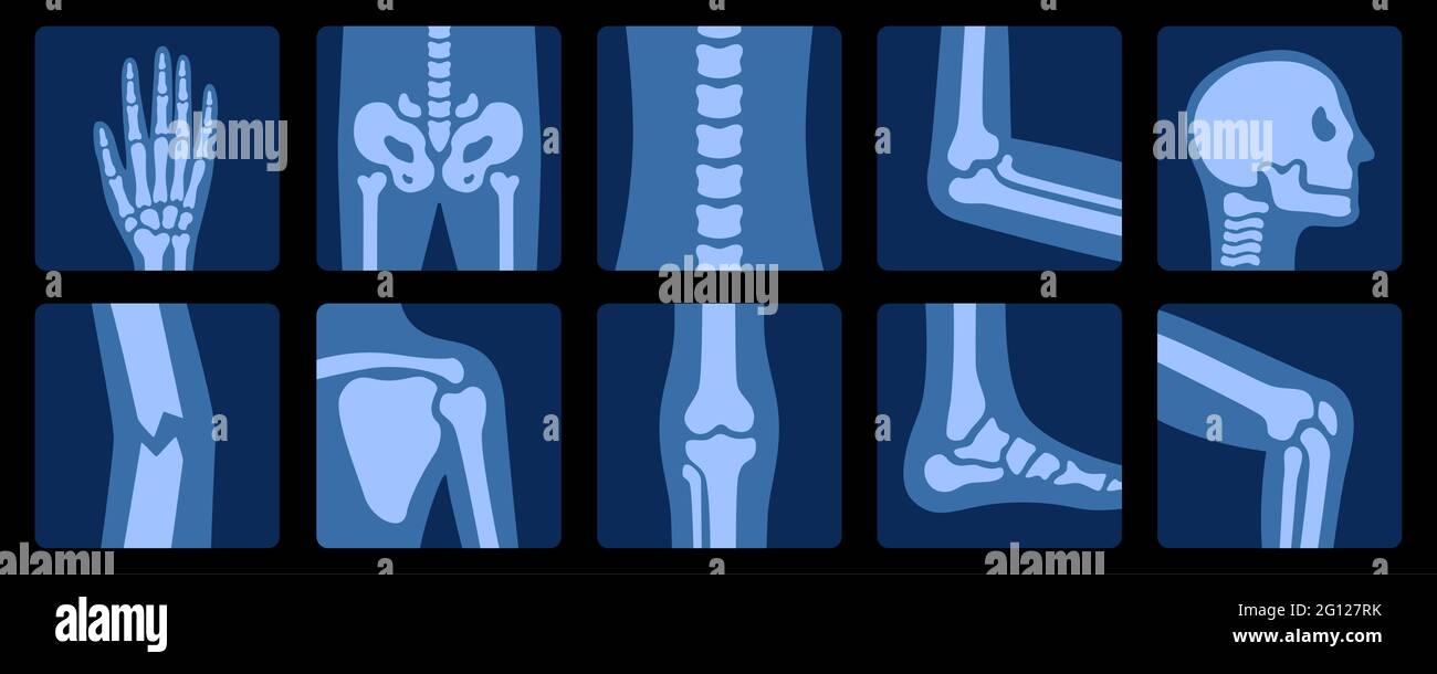 Raggi X delle ossa. Esame radiografico dell'anatomia articolare umana. Illustrazione medica, educativa e scientifica. Illustrazione Vettoriale