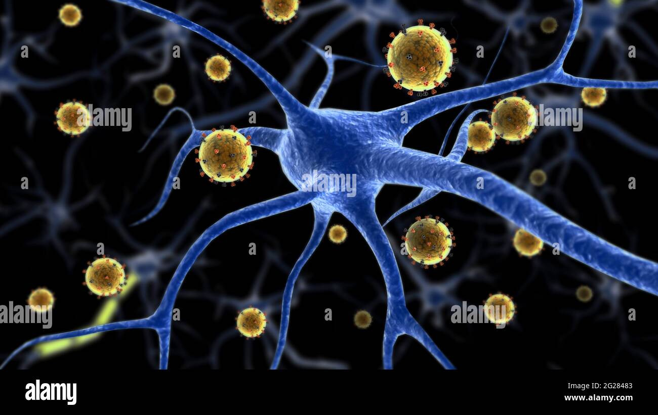 Illustrazione biomedica della malattia dell'encefalite equina orientale attaccata ad un neurone. Foto Stock