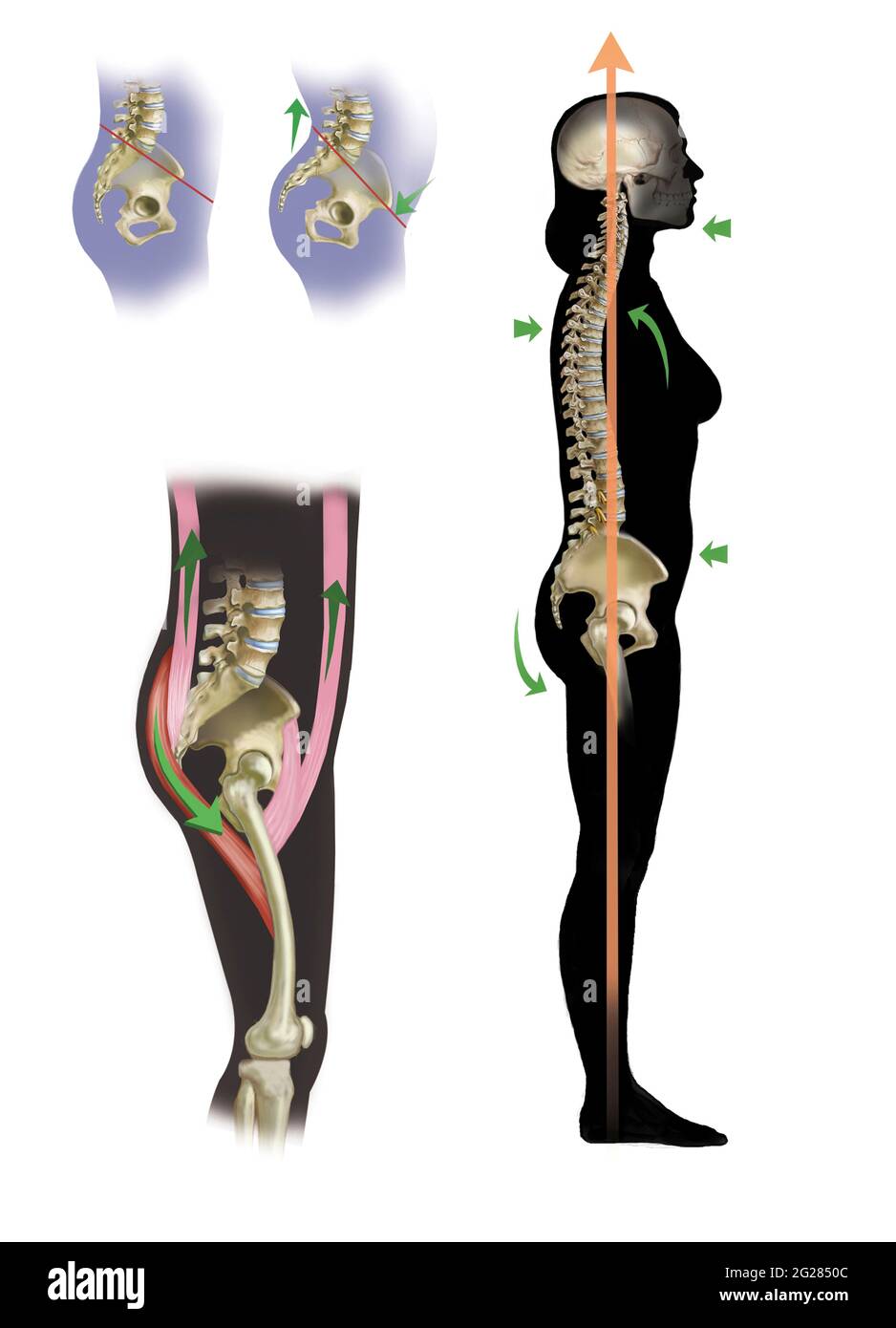 Posizione del bacino in posizione corretta e l'effetto dei muscoli dorsali e ventrali sul bacino. Foto Stock