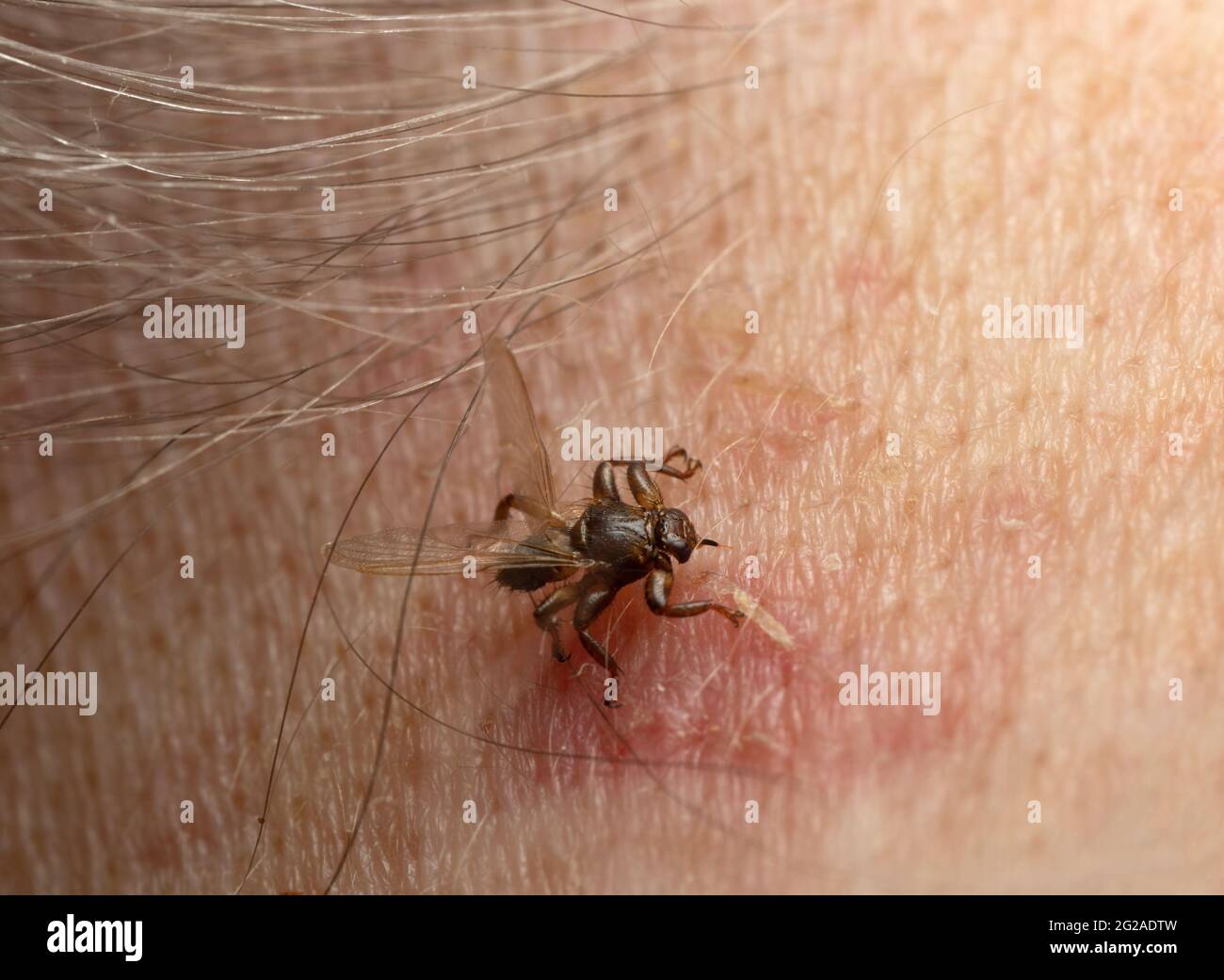 Cervi mosca, Lipoptena cervi che mordono sul collo umano, questo insetto è attivo durante l'autunno e può morso umano in rare occasioni Foto Stock