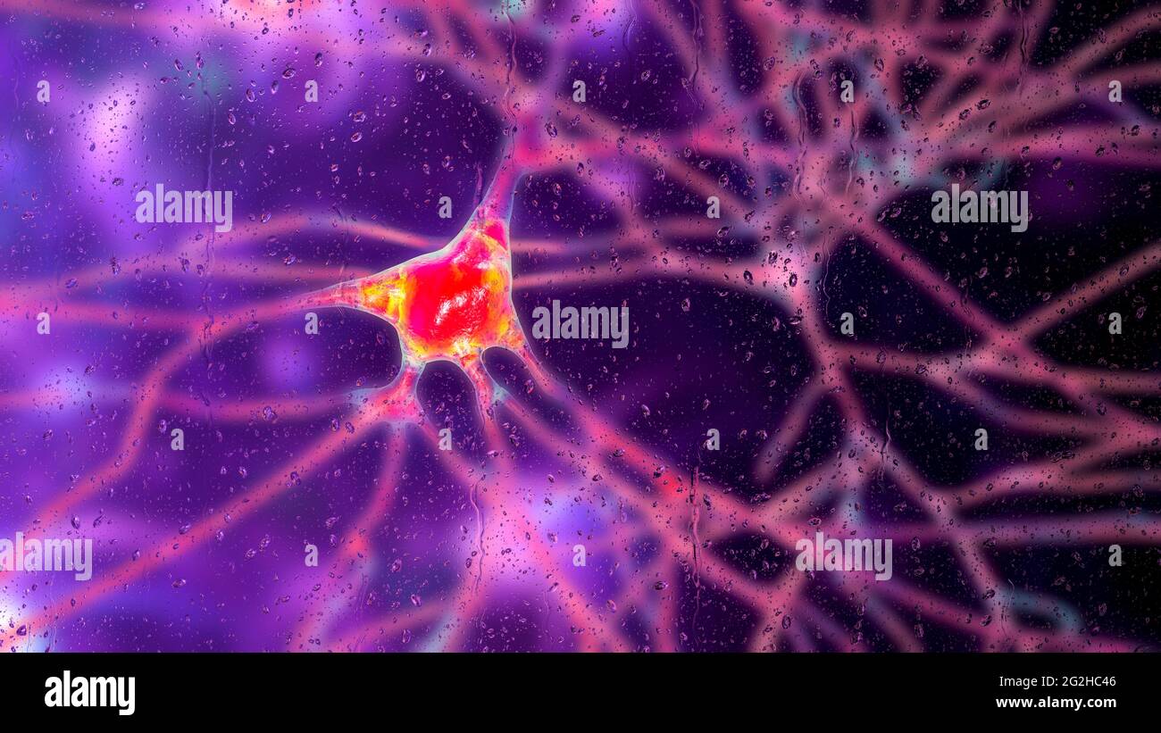 Neuroni nella demenza, illustrazione concettuale Foto Stock