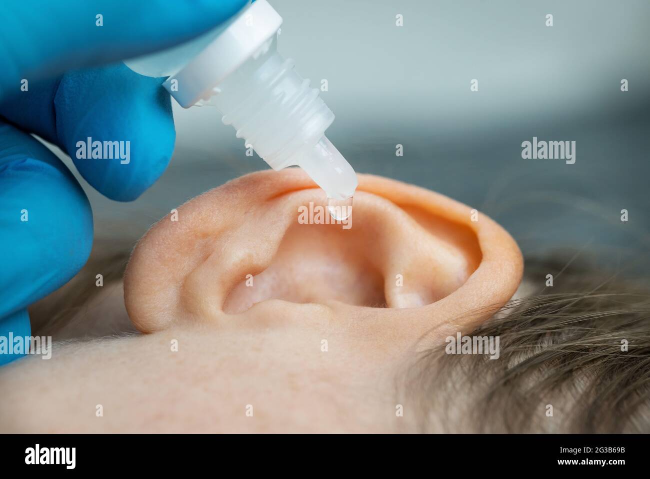 il medico gocciola l'orecchio nell'orecchio del paziente. il concetto di dolore all'orecchio e di orecchie ostruite Foto Stock