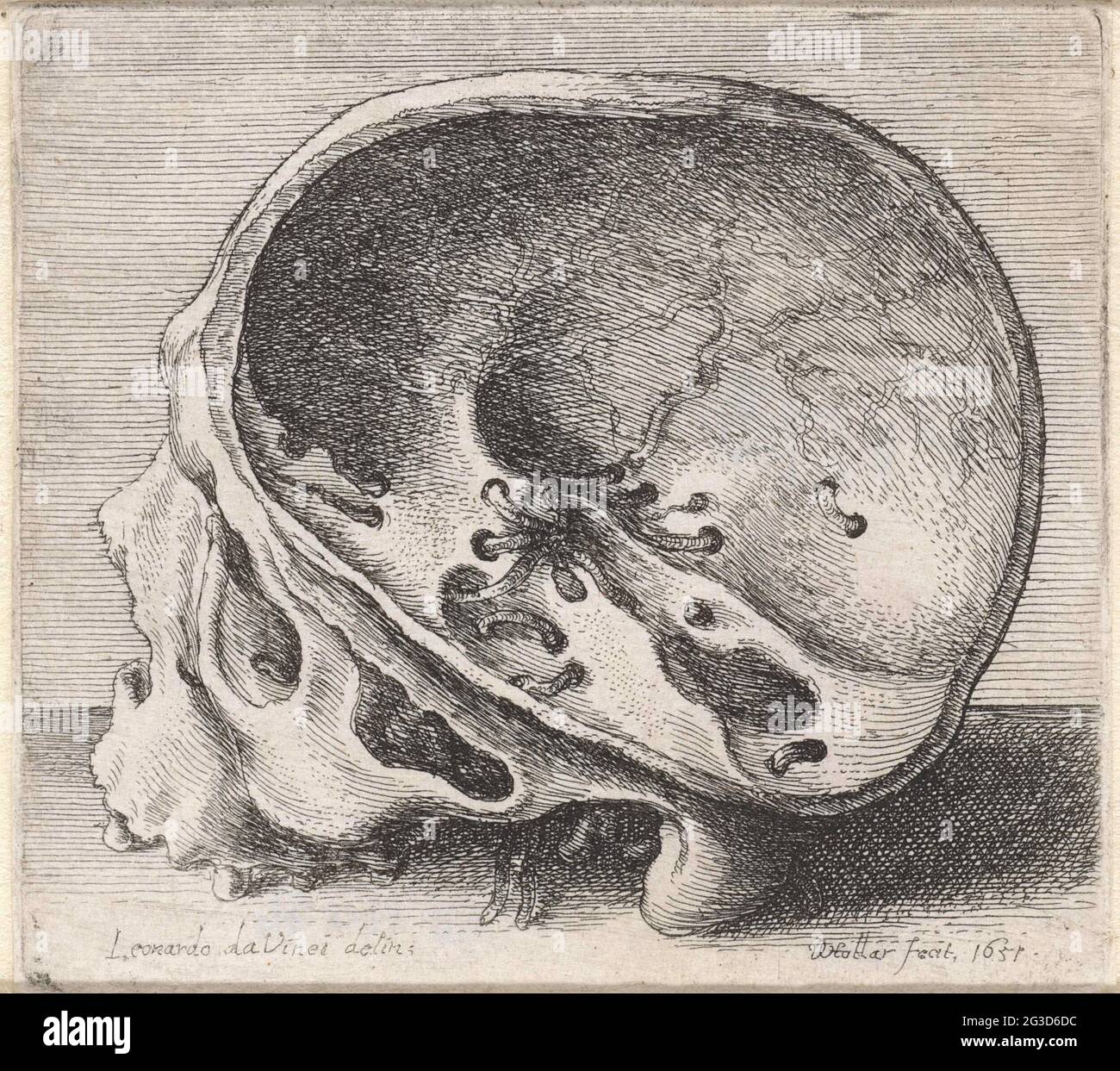 Studio anatomico di un cranio con fori di vite senza fine. . Foto Stock