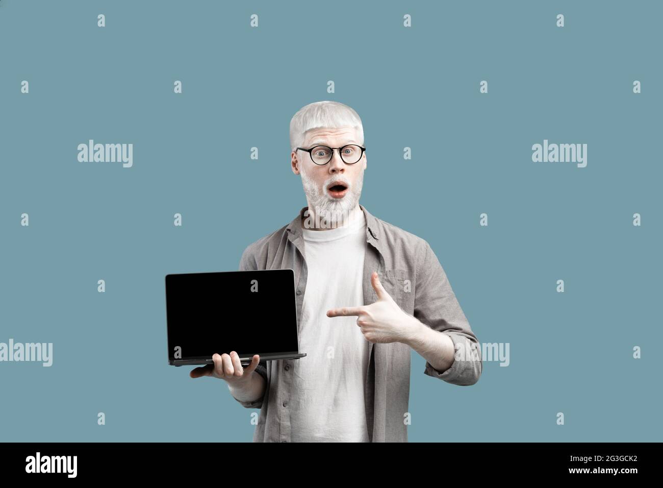 Grande pubblicità di Web site. Un uomo albino sorpreso che mostra lo schermo vuoto del notebook, puntandolo su uno sfondo turchese Foto Stock