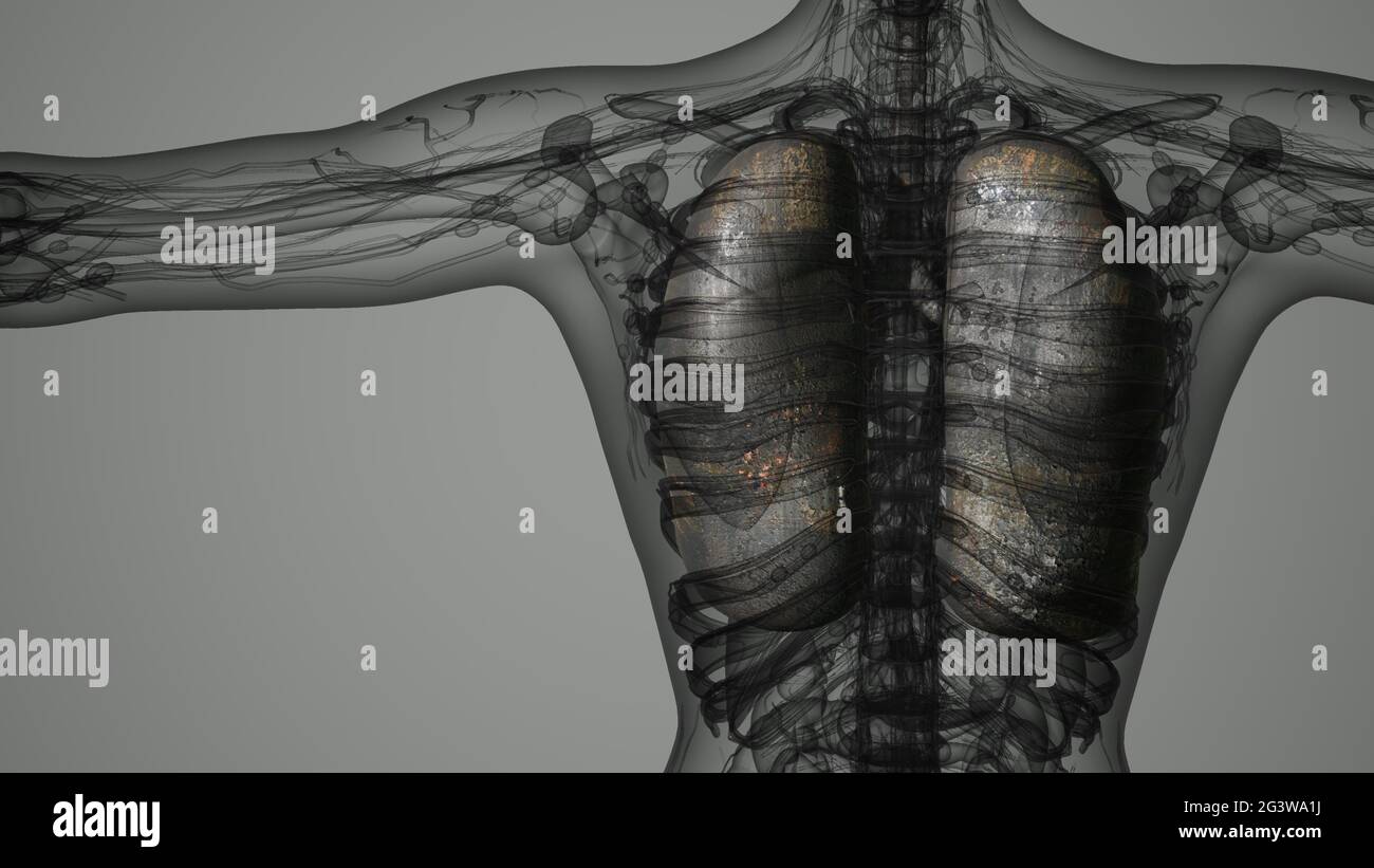 Polmoni umani esame radiologico Foto Stock