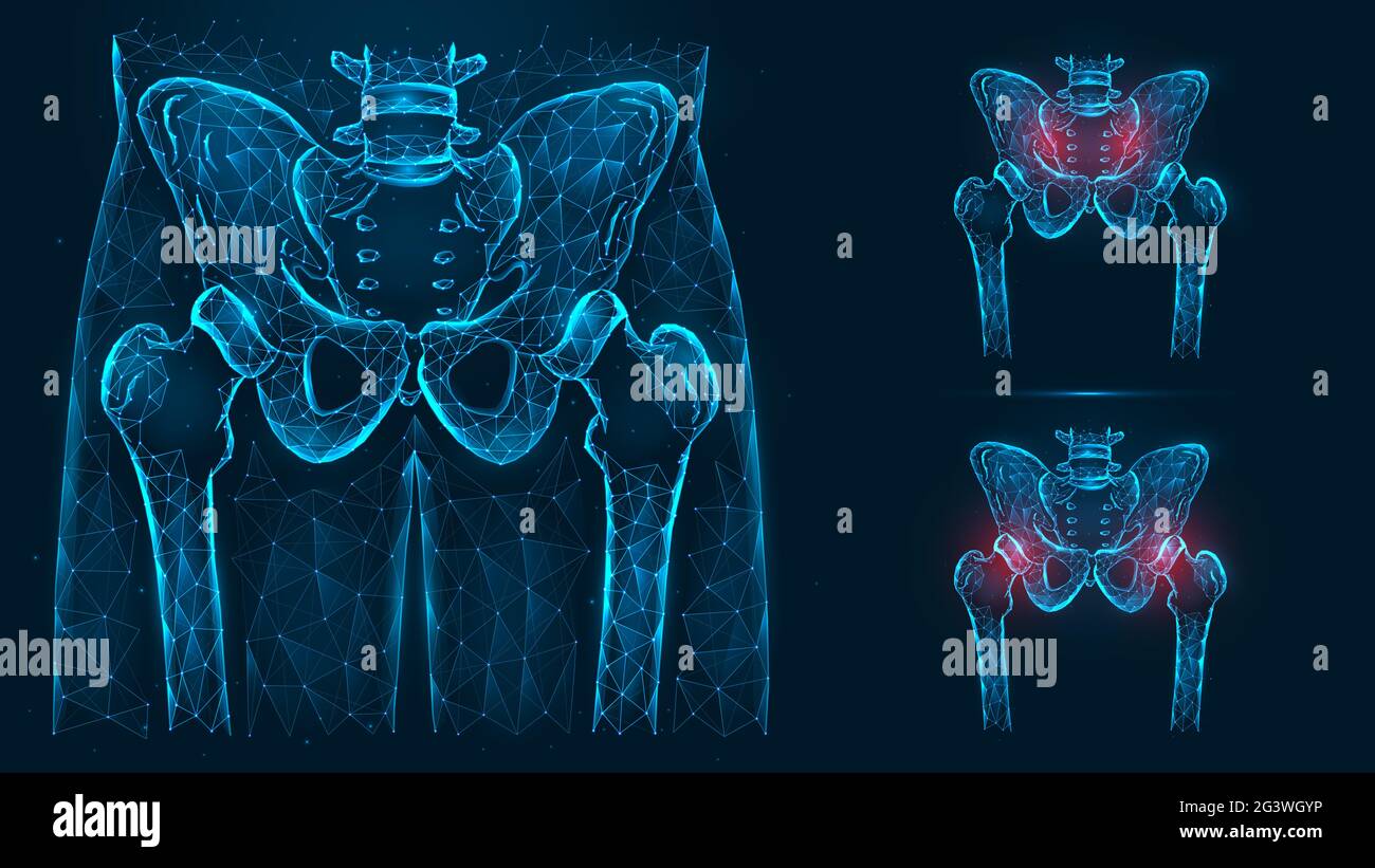 Ossa del bacino e dell'anca, anatomia umana. Lesioni pelviche e dell'anca. Raggi X dell'articolazione dell'anca costituiti da linee e punti isolati su b Foto Stock