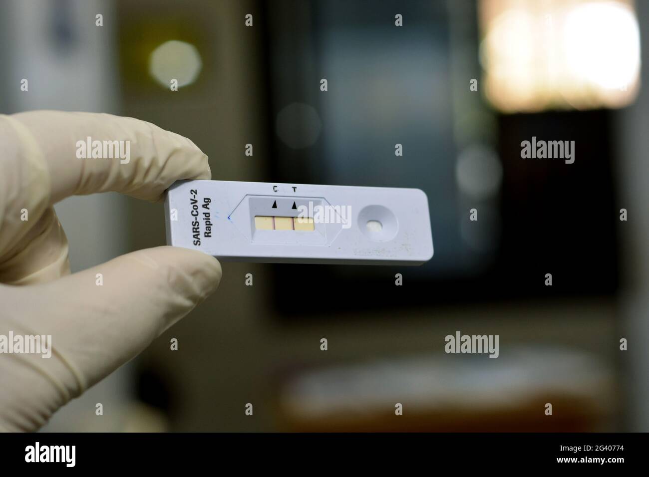 Un personale medico mostra un risultato positivo del test di SARS-COV-2 Rapid AG, test positivo del virus della corona di Covid-19 su sfondo sfocato, nuova pandemia c Foto Stock